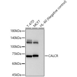 CALCR Rabbit pAb