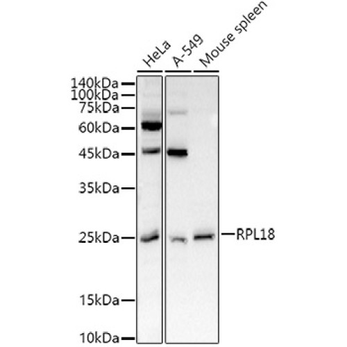 RPL18 Rabbit pAb