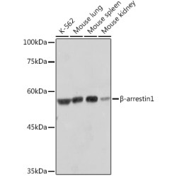 β-arrestin1 Rabbit mAb