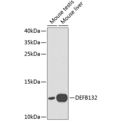 DEFB132 Rabbit pAb