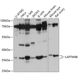 LAPTM4B Rabbit pAb