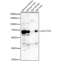 SLC27A2 Rabbit pAb