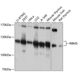 RBM5 Rabbit pAb