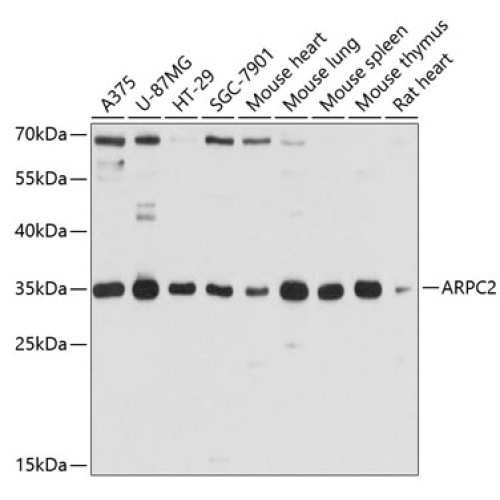 ARPC2 Rabbit pAb