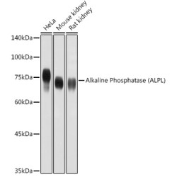 Alkaline Phosphatase (ALPL) Rabbit pAb