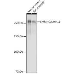 SMMHC/MYH11 Rabbit pAb