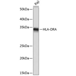 HLA-DRA Rabbit mAb
