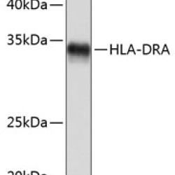 HLA-DRA Rabbit mAb