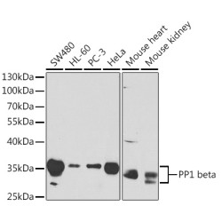 PP1 beta Rabbit pAb
