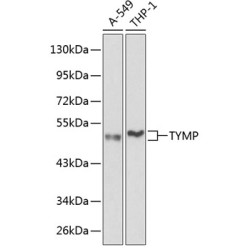 TYMP Rabbit pAb