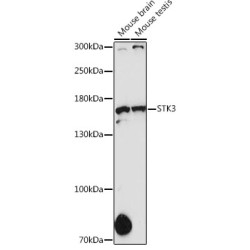 STK36 Rabbit pAb