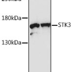 STK36 Rabbit pAb