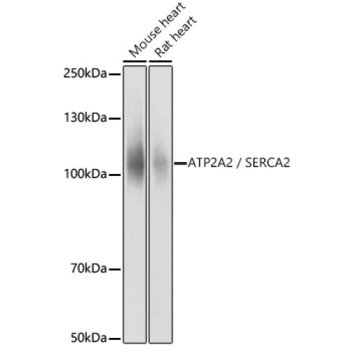 SERCA2/ATP2A2 Rabbit pAb