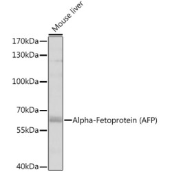 Alpha-Fetoprotein (AFP) Rabbit pAb