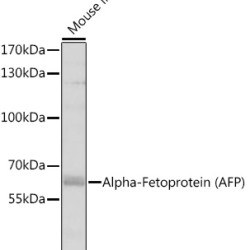 Alpha-Fetoprotein (AFP) Rabbit pAb