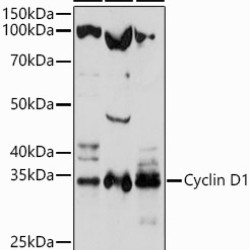 Cyclin D1 Rabbit pAb