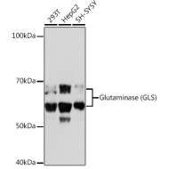 Glutaminase (GLS) Rabbit mAb
