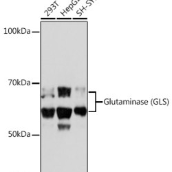 Glutaminase (GLS) Rabbit mAb