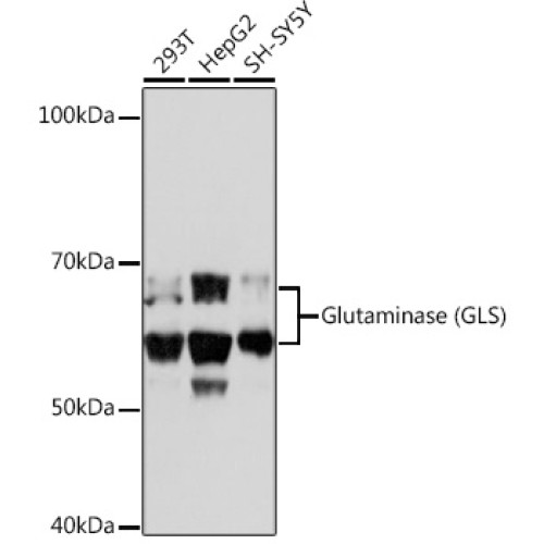 Glutaminase (GLS) Rabbit mAb