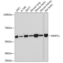 MMP11 Rabbit mAb