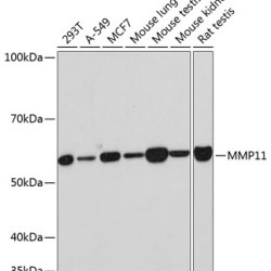MMP11 Rabbit mAb