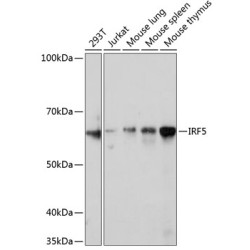 IRF5 Rabbit mAb