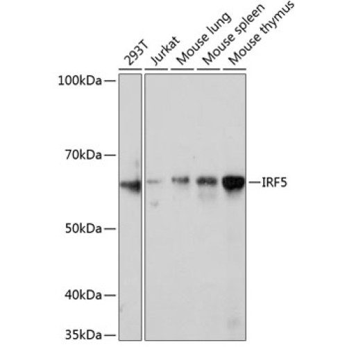 IRF5 Rabbit mAb