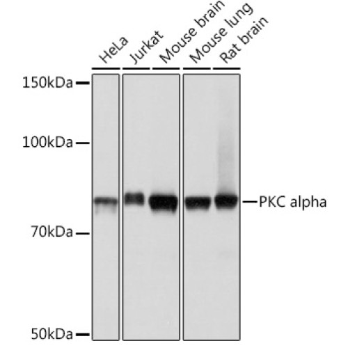 PKC alpha Rabbit mAb