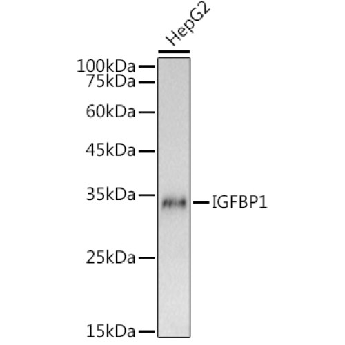 IGFBP1 Rabbit pAb