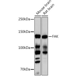 FAK Rabbit mAb