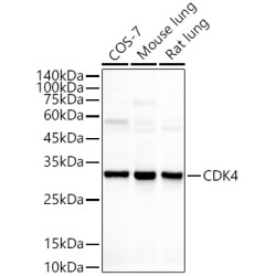 [KO Validated] CDK4 Rabbit mAb