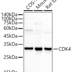 [KO Validated] CDK4 Rabbit mAb