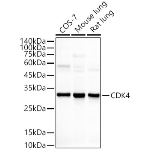 [KO Validated] CDK4 Rabbit mAb