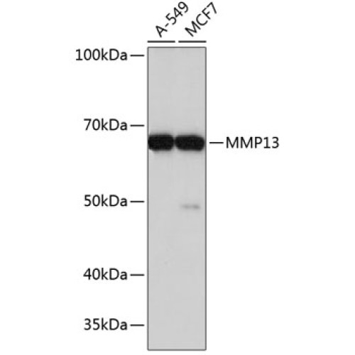 MMP13 Rabbit mAb