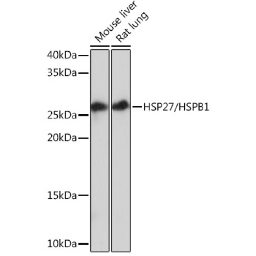 HSP27/HSPB1 Rabbit mAb