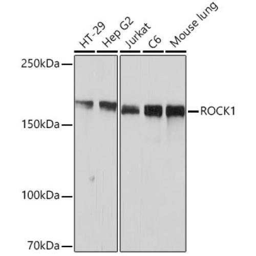 ROCK1 Rabbit mAb