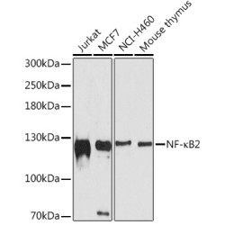 NF-κB2 Rabbit pAb