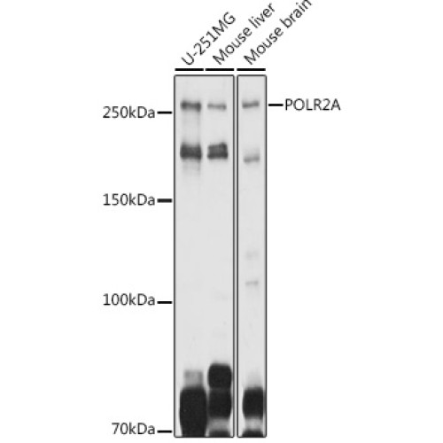 POLR2A Rabbit pAb