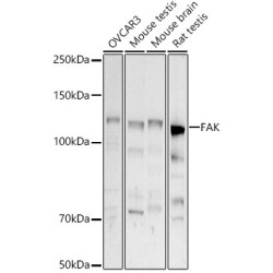 [KD Validated] FAK Rabbit pAb
