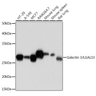 Galectin 3/LGALS3 Rabbit mAb