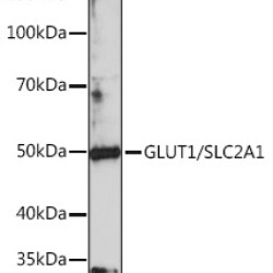GLUT1/SLC2A1 Rabbit pAb