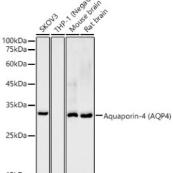 Aquaporin-4 (AQP4) Rabbit mAb