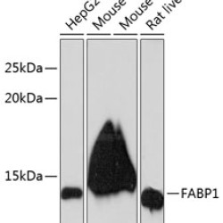 FABP1 Rabbit mAb