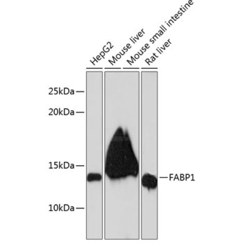 FABP1 Rabbit mAb