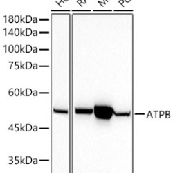 ATPB Rabbit mAb