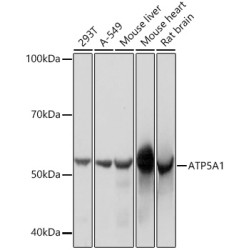 ATP5A1 Rabbit mAb