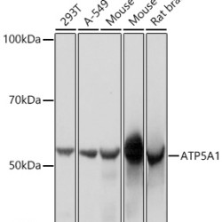 ATP5A1 Rabbit mAb
