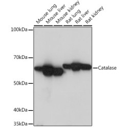 Catalase Rabbit mAb