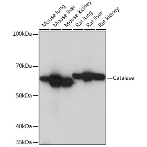 Catalase Rabbit mAb