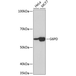 G6PD Rabbit mAb